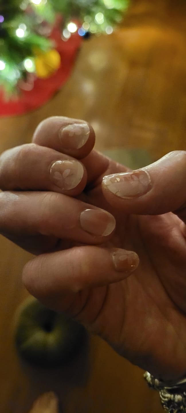 Customer photo review of Nourishing Cuticle Oil Pen & Gellae Nail Remover