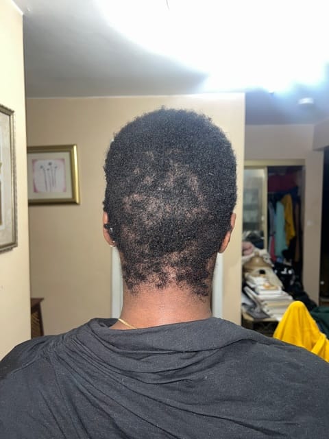 Customer photo review of The Hair System