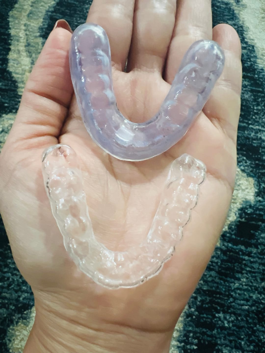 Customer photo review of 3mm Dual-Layer Hybrid Night Guard for Teeth Grinding - Ideal to Protect Veneers, Crowns, Implants