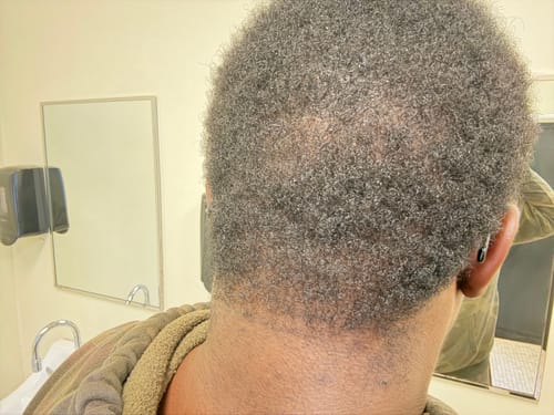 Customer photo review of Healthy Hair Starter Kit- Limited Edition