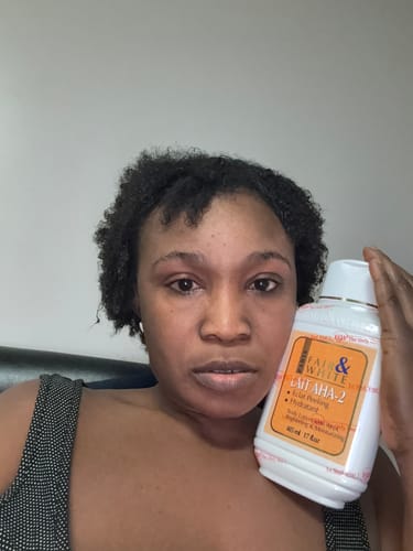 Customer photo review of Fair and White AHA Body Lotion  500ml
