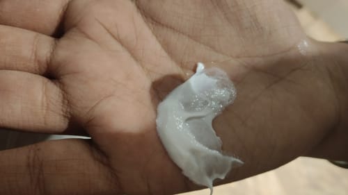 Customer photo review of Multi Purpose Face Moisturizer & Cream - Feather Touch Moisturizer