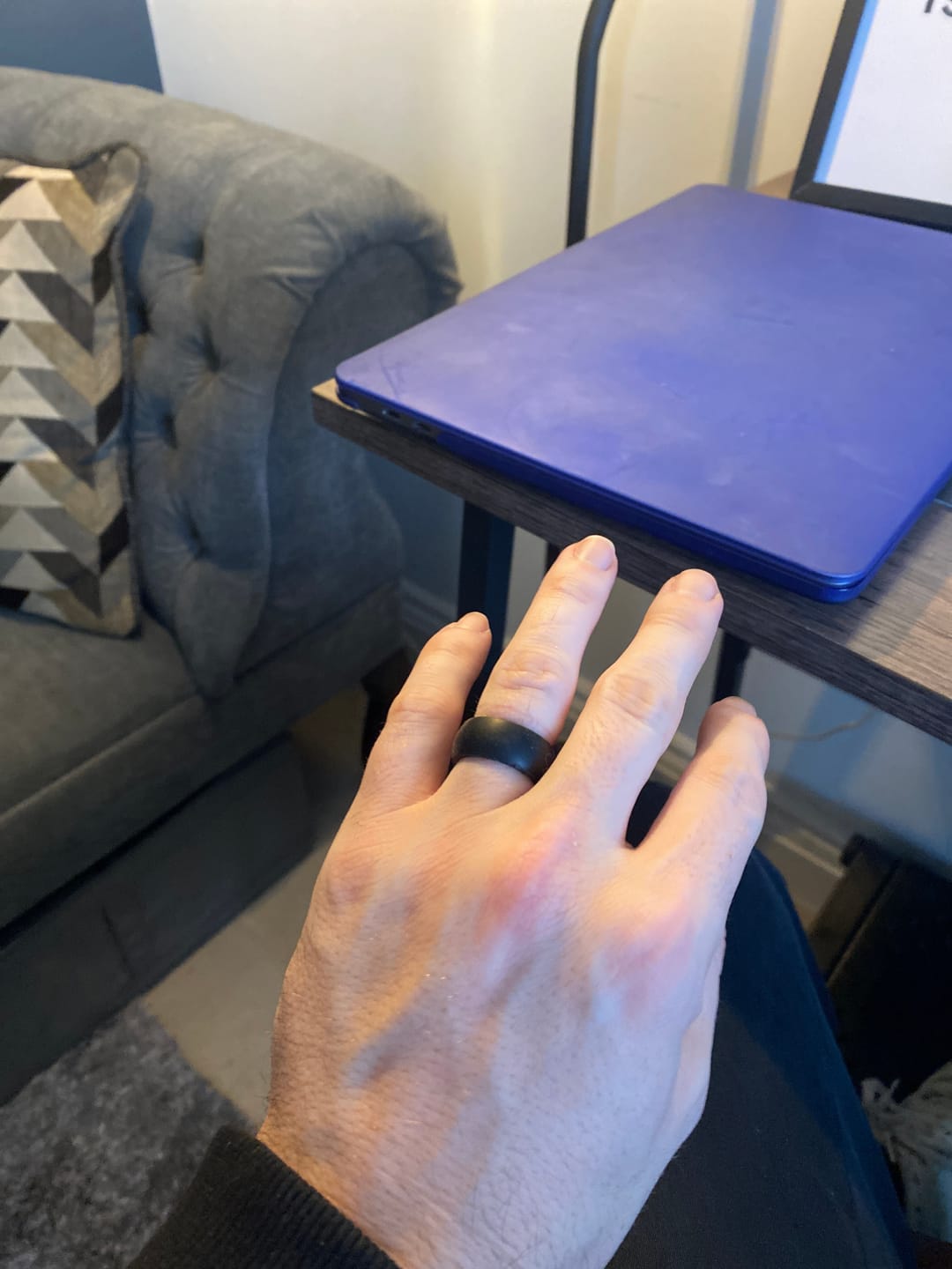 Customer photo review of botthms Black Active Silicone Ring