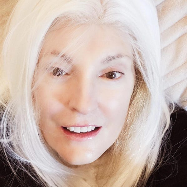 Customer photo review of Women White Lace Front Long Straight Widow's Peak Hairline Slicked Back Hair Wig