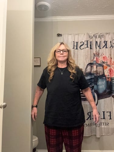 Customer photo review of Semaglutide Weight Loss Program