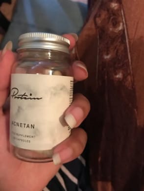 Customer photo review of Acnetane | Get rid of stubborn Acne | 60 Capsules