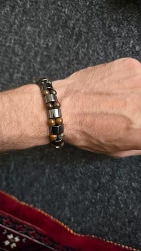 Customer photo review of DIGESTIVE BRACELET