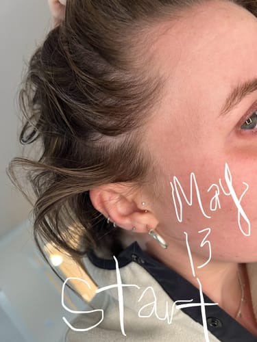 Customer photo review of Pre-Wash Scalp Oil by TR