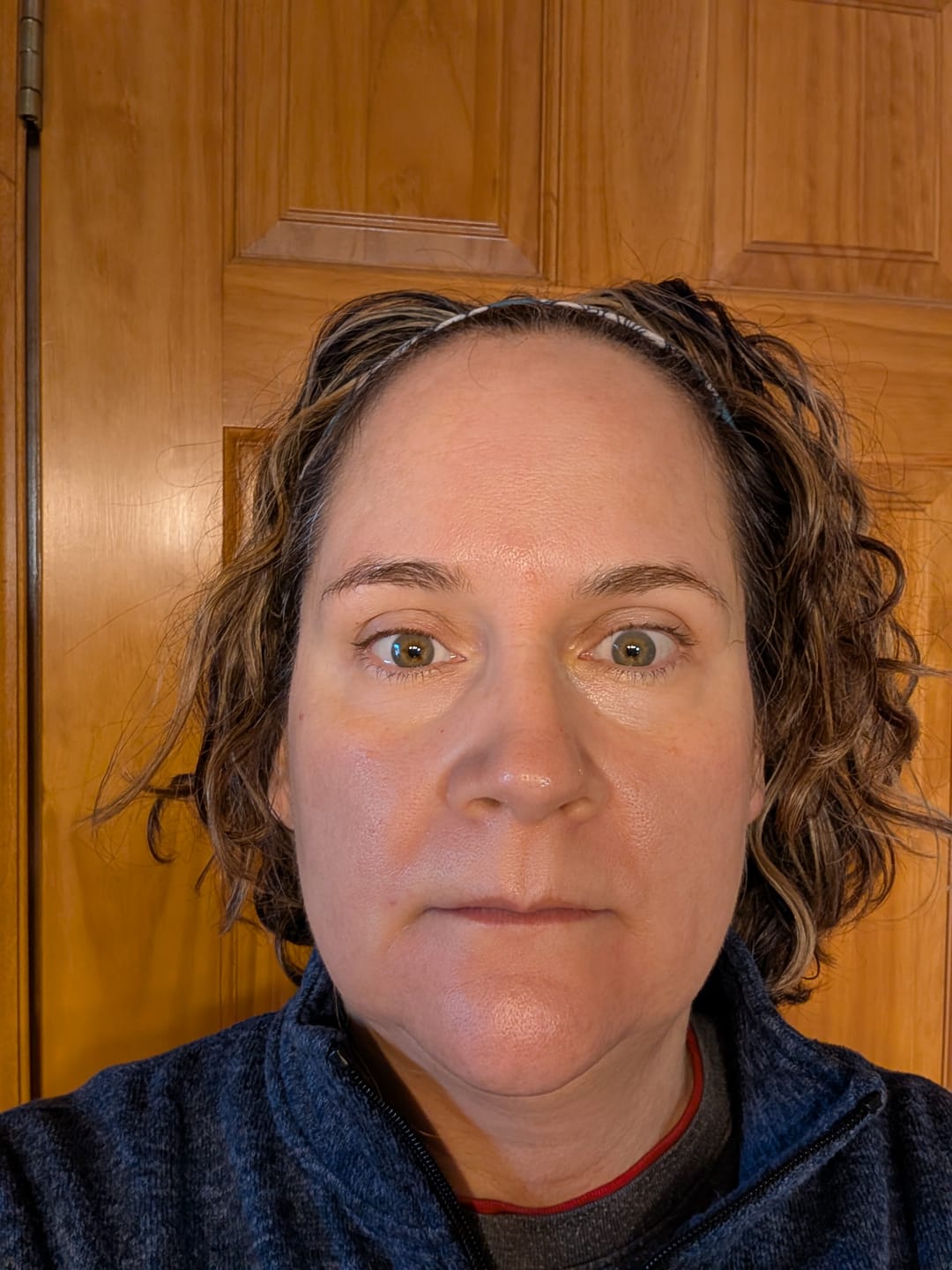 Customer photo review of Glov Anti-Aging Serum (5ml)