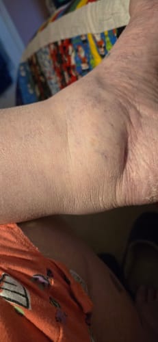 Customer photo review of Two Step