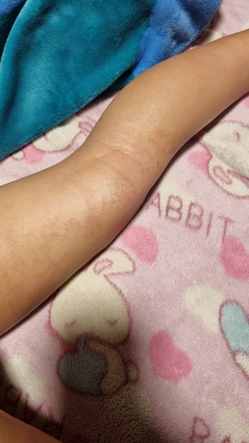 Customer photo review of Kawakawa Repair Balm - Winner, Best SOS/Healing Balm 2024