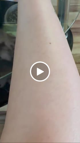 Customer video review of Depilador Nano Pro