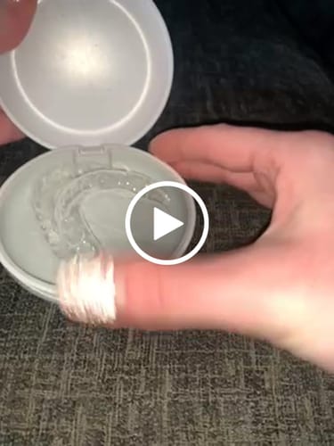 Customer video review of Professional Whitening Trays
