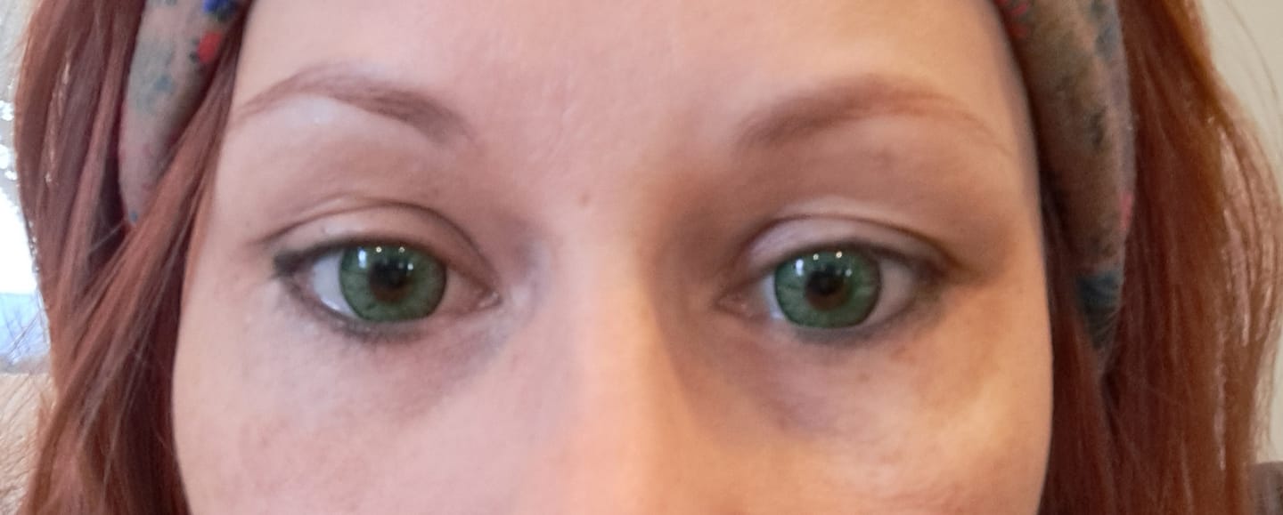 Customer photo review of Vega Bright Forest Green Prescription Colored Contact Lenses