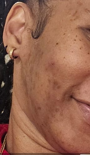 Customer photo review of Turmeric Glow Soap