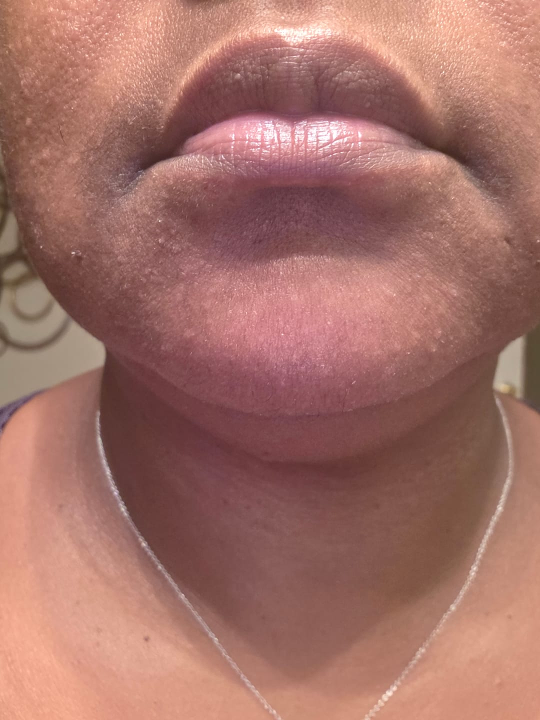 Customer photo review of Brightening Lip Bundle