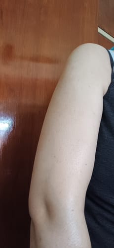 Customer photo review of Bumps Be Gone