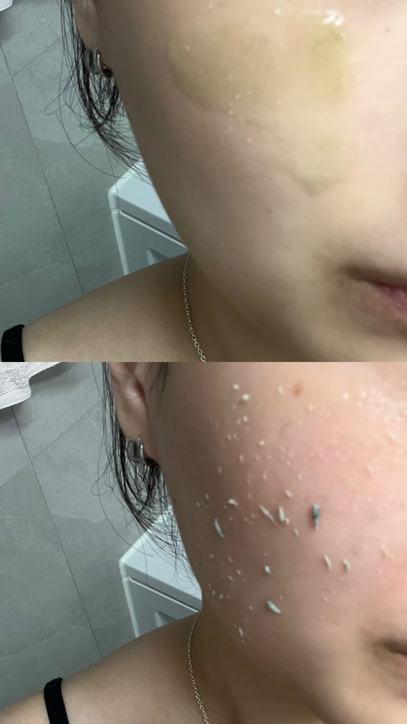 Customer photo review of Madeca Matcha Toning Peeling Gel 150ml