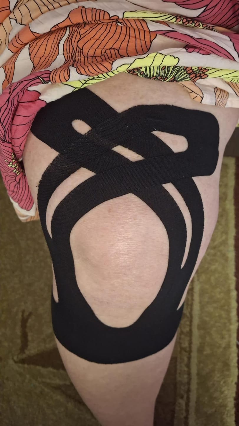 Customer photo review of Flex Pro - Bandes pour genoux