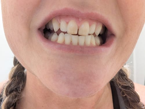 Customer photo review of Mouthology Toothpaste (1 pack)