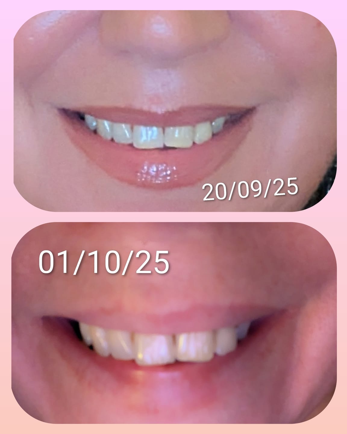 Customer photo review of Water Flosser