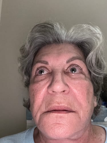 Customer photo review of Grass Fed Tallow & Honey Balm