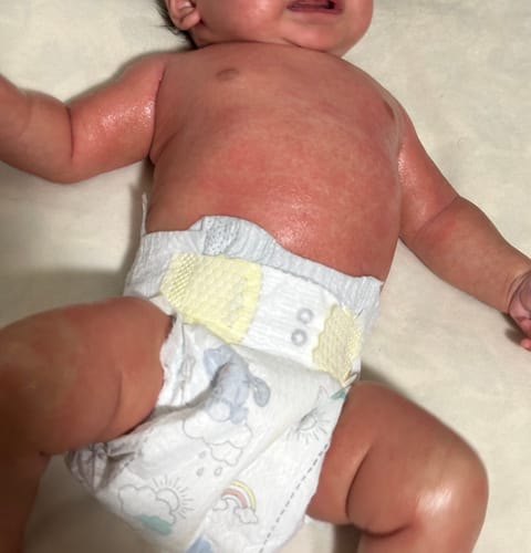 Customer photo review of All Over Ointment Eczema Treatment