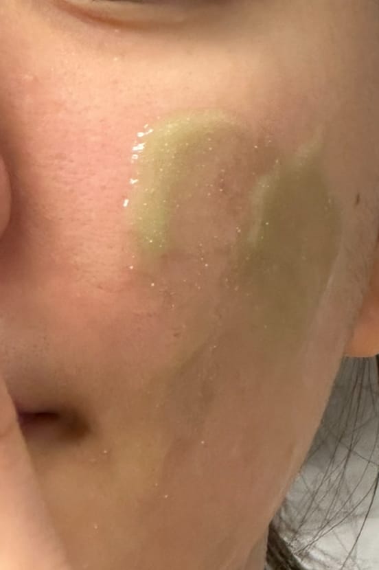 Customer photo review of Madeca Matcha Toning Peeling Gel 150ml