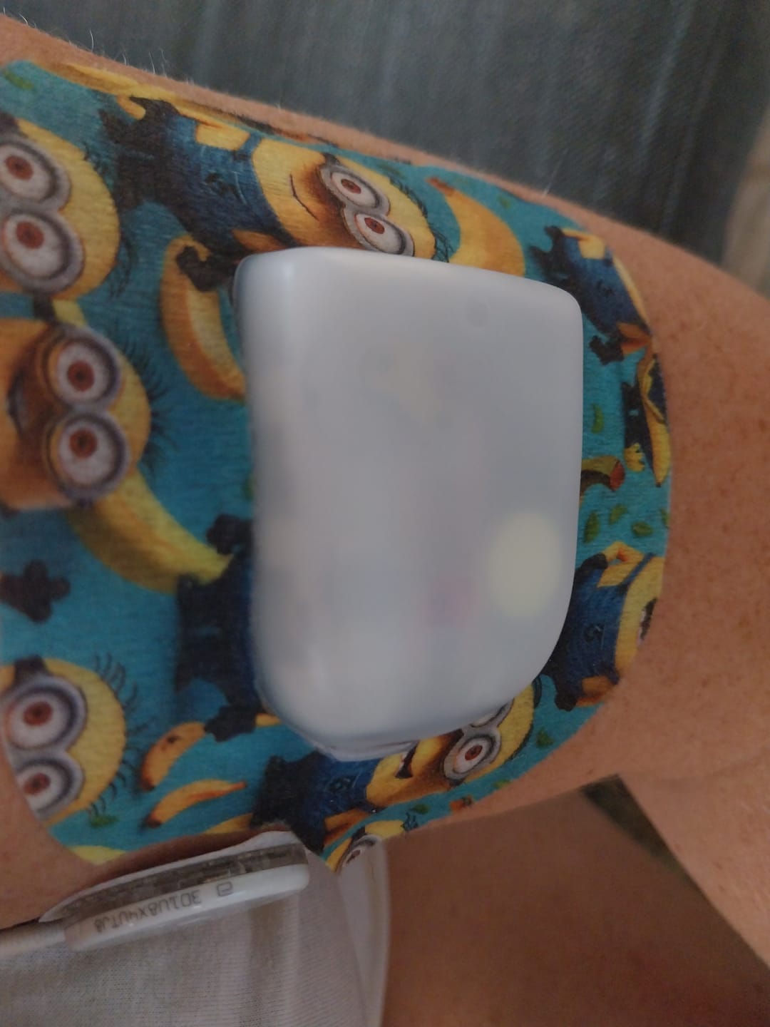 Customer photo review of Minions Universal Pump Overpatches för Omnipod 5 & Dash – inkl. Pumpsticker