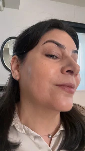 Customer photo review of Wrinkle Defense Balm - ByLorai