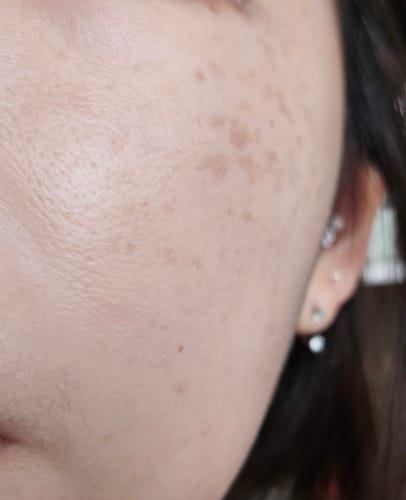 Customer photo review of OUTGLOW - Radiance Tri-Factor™ Jelly