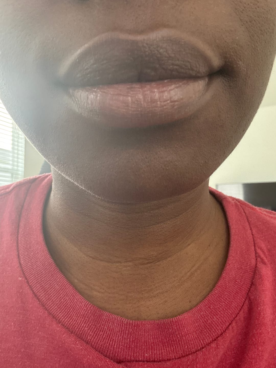 Customer photo review of Lips Lightening Cream For Men and Women (Results in 5 Days or Less)