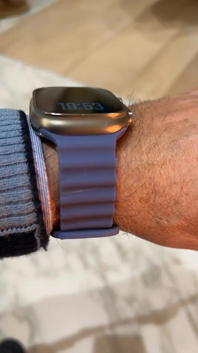 Customer photo review of S10 Pro Max Smart Watch + 7 narukvica