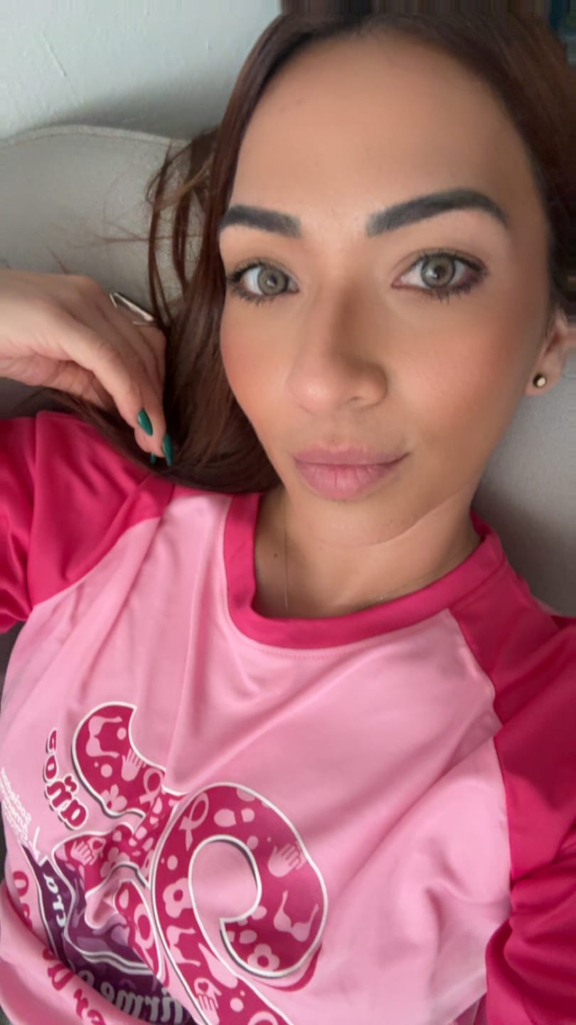 Customer photo review of Citha Hazel Brown Prescription Colored Contact Lenses