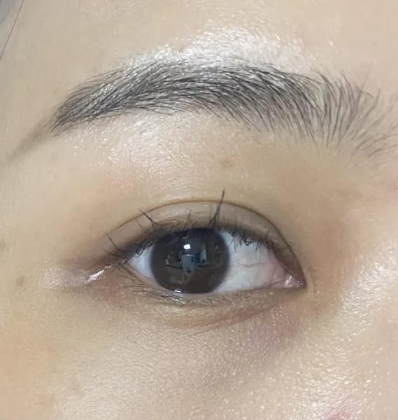 Customer photo review of Wrinkle Defense Balm - ByLorai