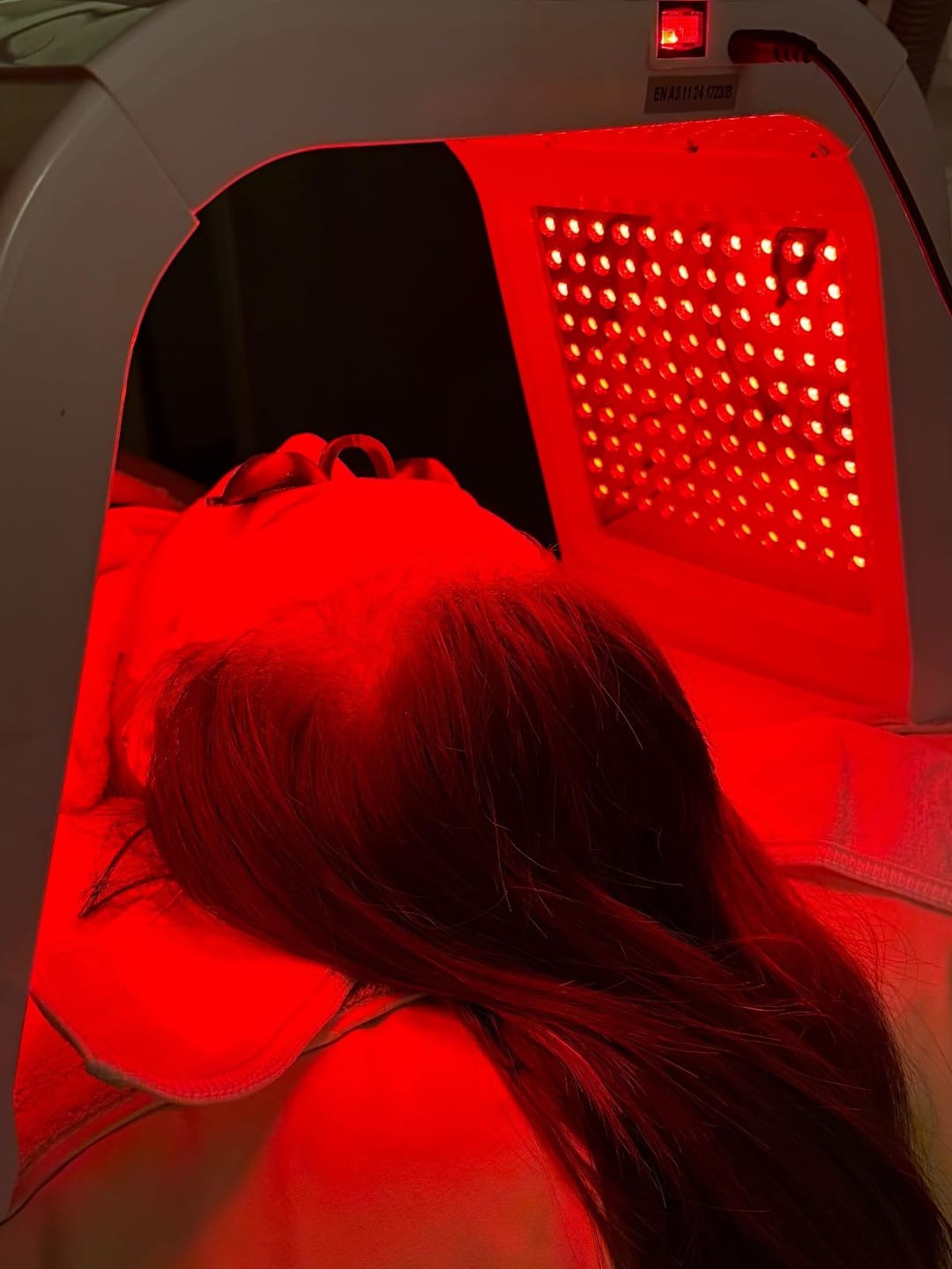 Customer photo review of Nicebeam 9-in-1 Laser Light Therapy Lamp for Skin Rejuvenation & Hair Growth - Combat Hair Loss & Improve Skin Health