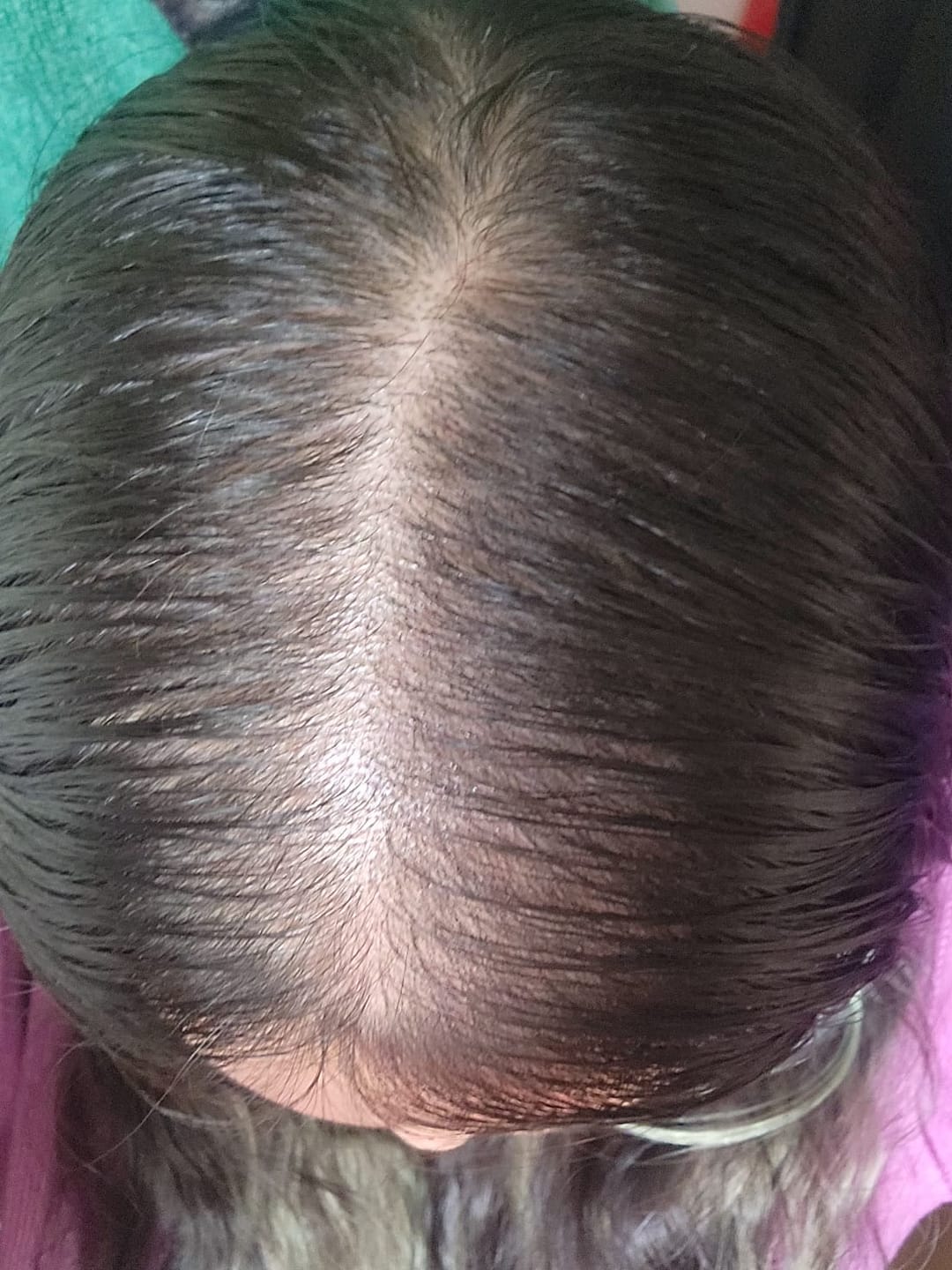 Customer photo review of Tónico Anticaída
