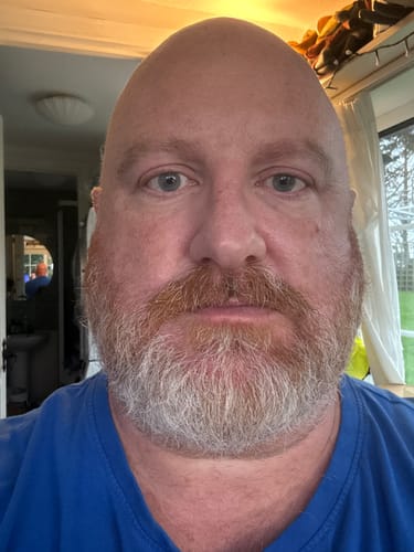 Customer photo review of Seb Natural Soothing Balm