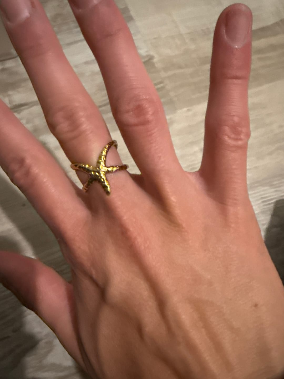 Customer photo review of Sunstar Ring (Bundle)