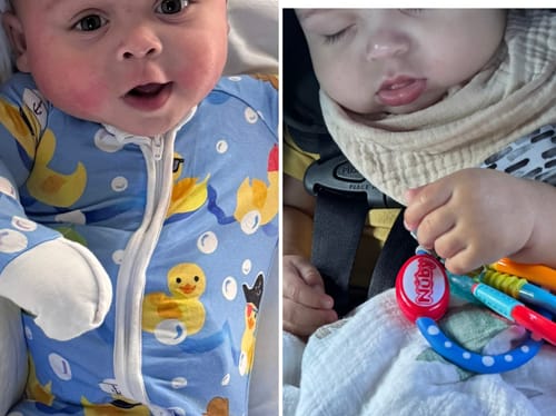 Customer photo review of All Over Ointment Eczema Treatment