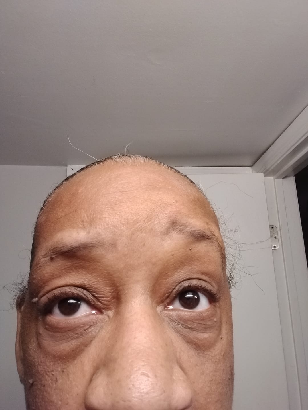 Customer photo review of HYDRATING CREAM | BARRIER SUPPORT