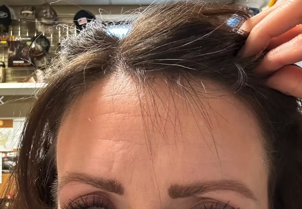 Customer photo review of Hair Growth Max Liposomal