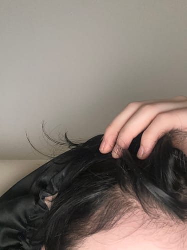 Customer photo review of VITAFOAM ™ Hair Growth Formula