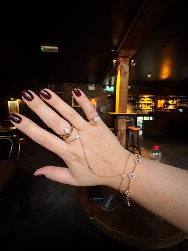 Customer photo review of Lumi Clover Bracelet