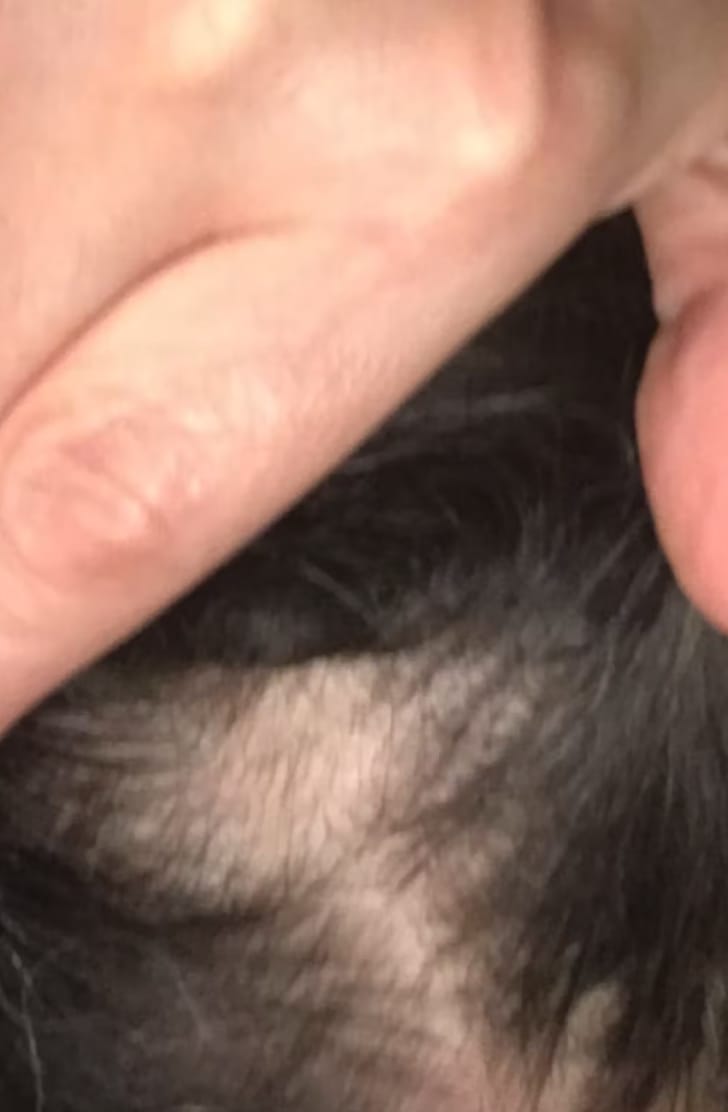 Customer photo review of Hair Growth Max Liposomal
