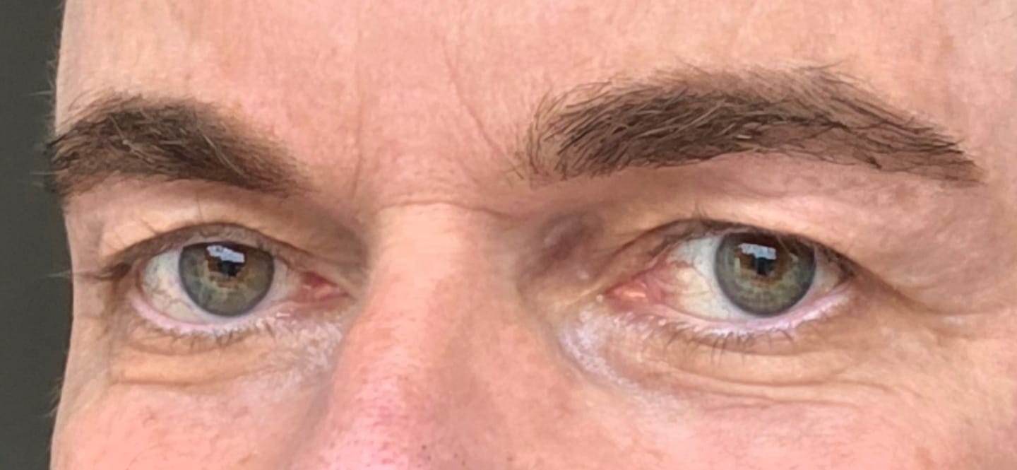 Customer photo review of BROWCOCA!NE - Augenbrauenserum