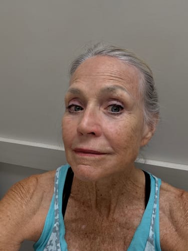 Customer photo review of F-Balm - Premium Anti-aging Tallow Balm - 2 oz.