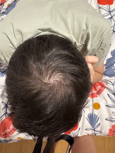 Customer photo review of Cell Happy Co - Toner anti-chute de cheveux - 120ml