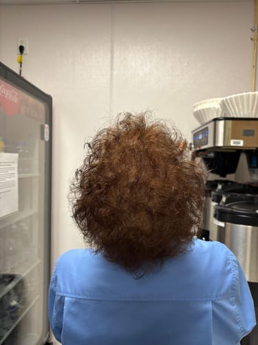 Customer photo review of Glov Hair Regrowth System