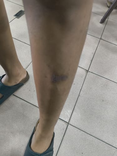 Customer photo review of Jolicare Cream